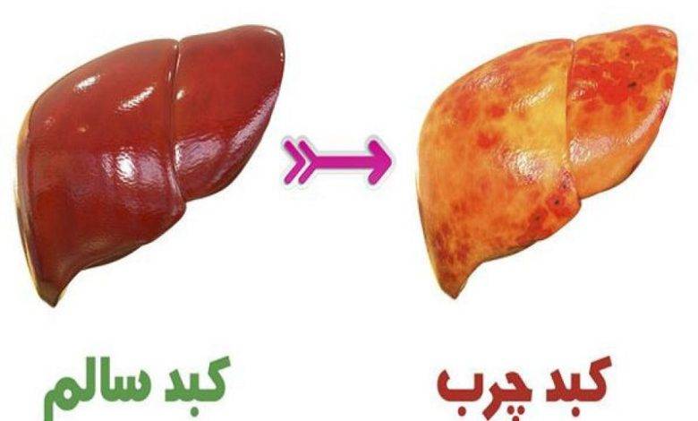 کبد و بیماری های کبدی